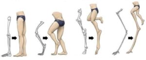 rodilla y tobillo de los flamencos