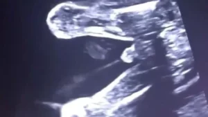 bebes en el utero beben su propia orina