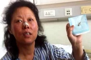 china Zhao bala alojada en la cabeza